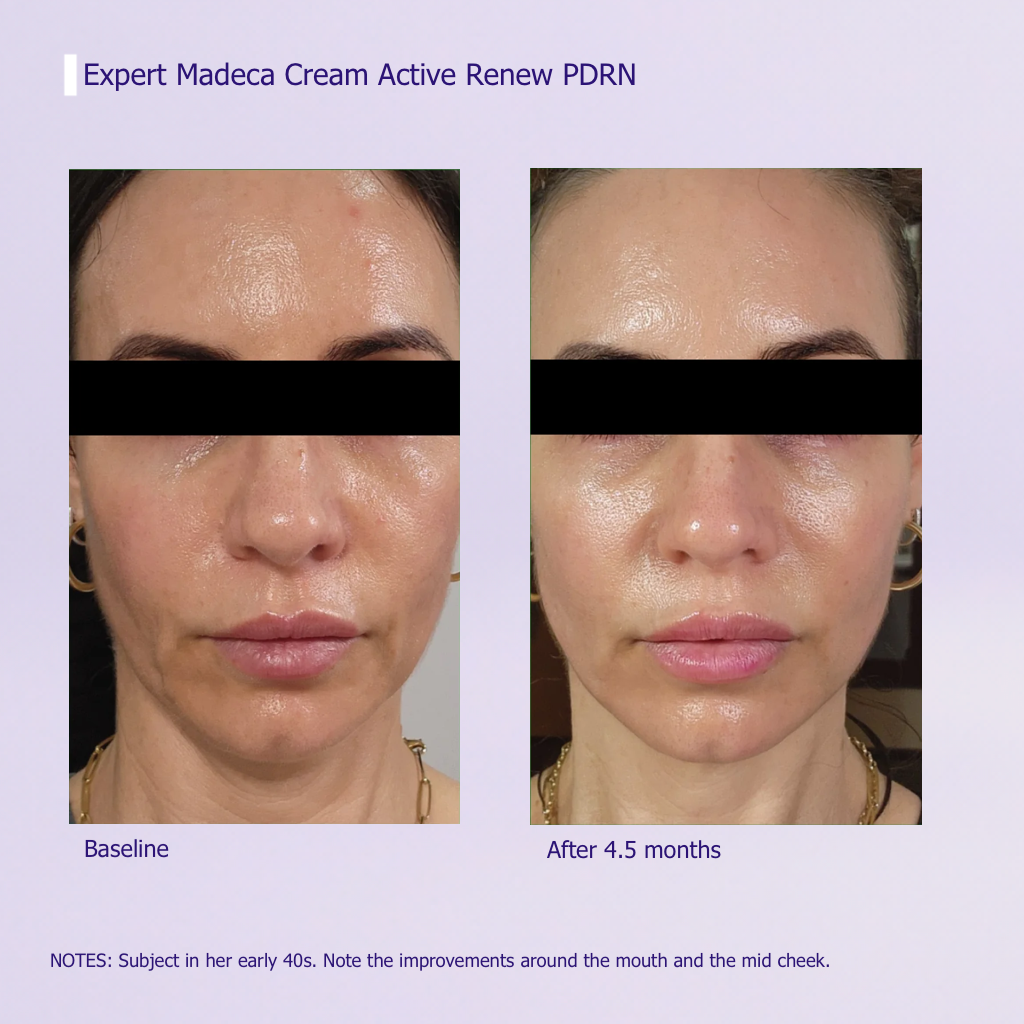 Expert Active Renew Cream