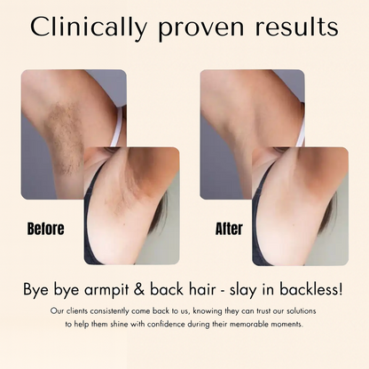 PLANTEVA™ Cyperus Rotundus – Root-Targeting Hair Reduction Serum