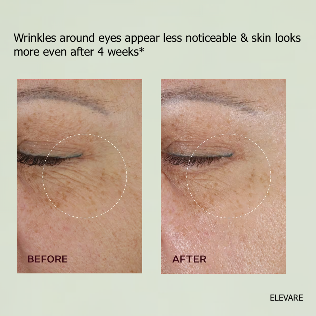 ELEVARE –  A Retinal Shot Tightening Booster