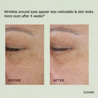 ELEVARE –  A Retinal Shot Tightening Booster