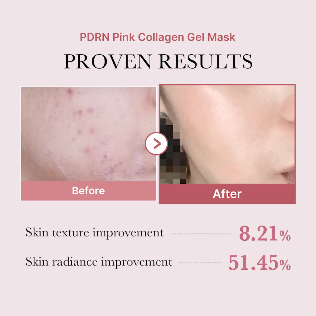 PDRN Infused Pink Collagen Gel Mask - Pack of 4
